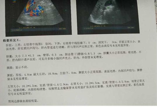 出血原因千千万，此例患者为哪般？