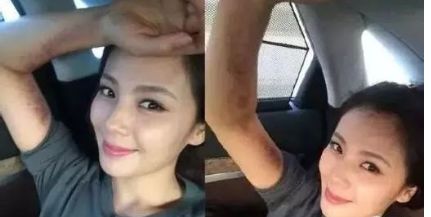 闃垮▏鏅掑埉鐥ф不鐤楃収,闃垮▏鑴搁儴鍒棫