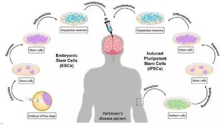 中国干细胞临床试验,中国干细胞最新案例