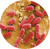 益生菌一般菌株含量多少,益生菌种类图鉴