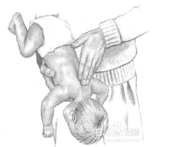 气管误吸异物怎么处理,如何防止孩子误吸异物