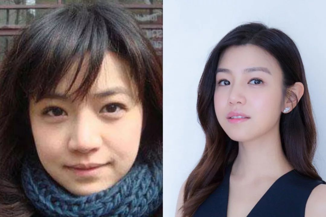 赵丽颖是怎么让脸变薄的,赵丽颖脸是不是有点变了