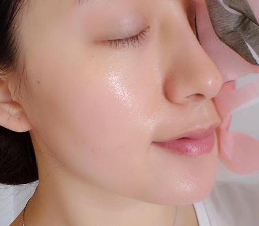 小苏打祛斑,纯天然面膜祛斑