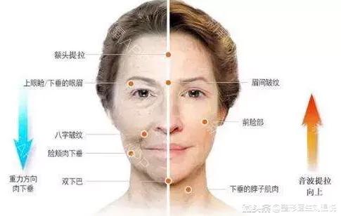 微整形要注意些什么,微整形要注意什么