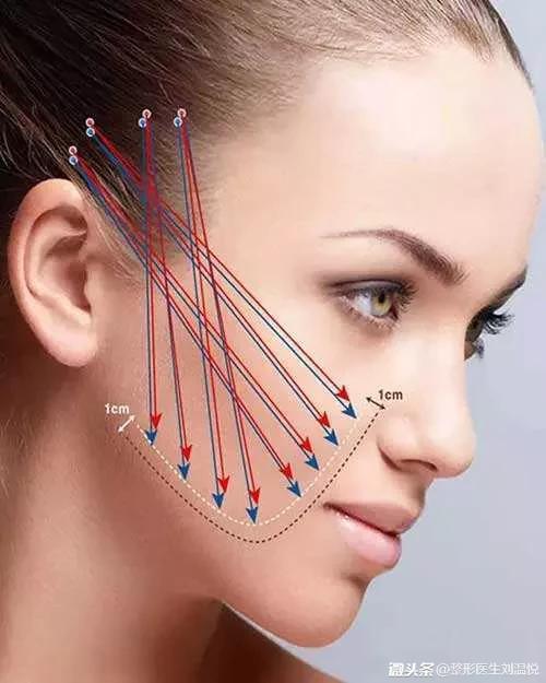 微整形要注意些什么,微整形要注意什么