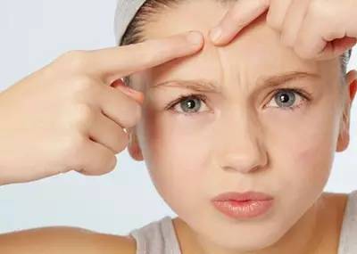 淡痘印效果好的护肤品测评推介,战痘护肤品测评