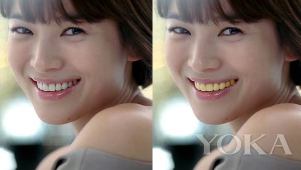 大变脸原来整牙才是高颜值,女星整牙都是越整越美