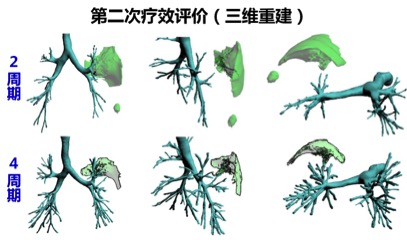 华莹奇医生援鄂了吗,华莹奇