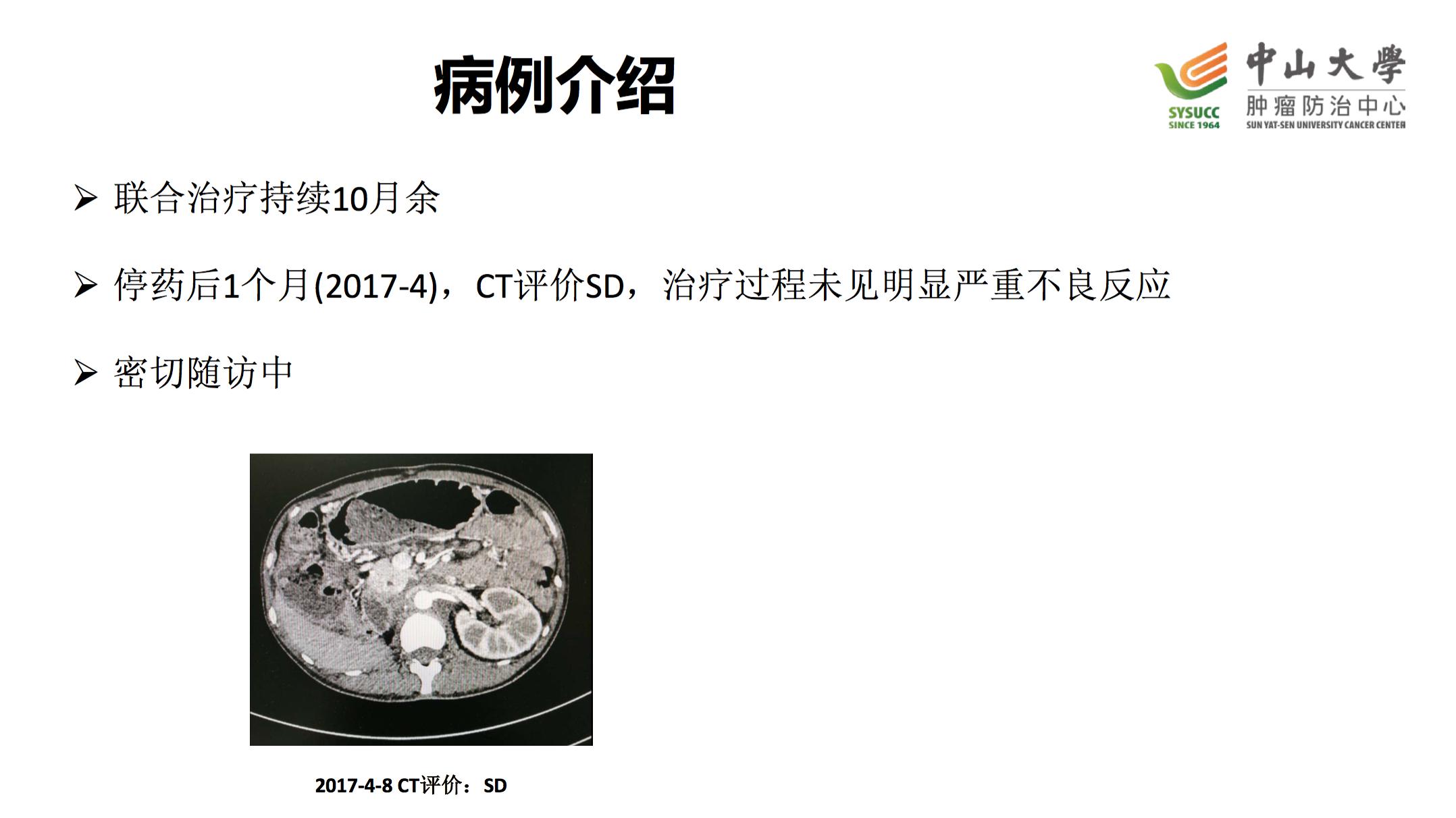 阿昔替尼联合pd-1治疗肾癌,肾癌阿昔替尼耐药后怎么治疗