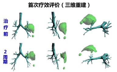 华莹奇医生援鄂了吗,华莹奇