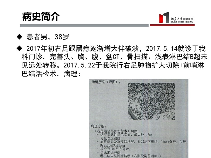 黑色素瘤怎么判定几期,黑色素瘤深度达到多少可以治愈
