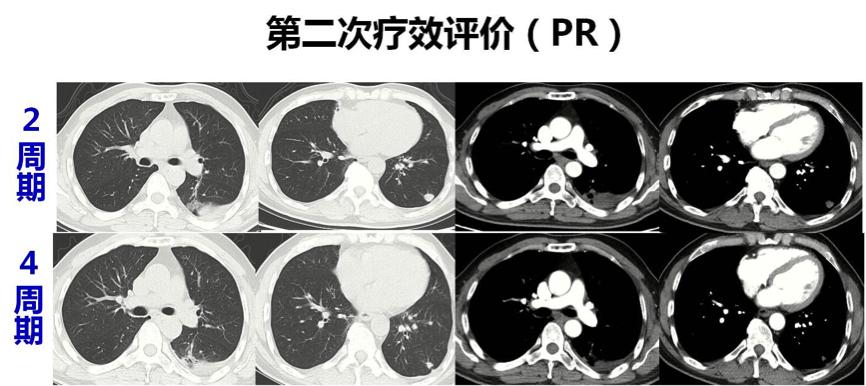 华莹奇医生援鄂了吗,华莹奇