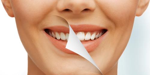 每天刷牙牙齿还是发黄是怎么回事,饮用含氟量过大的水导致牙齿发黄