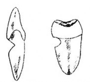 口腔医学教你如何正确刷牙,横拉锯式刷牙