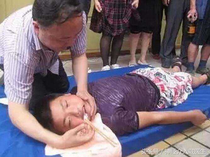 外伤性癫痫用药,外伤性癫痫的症状有哪些