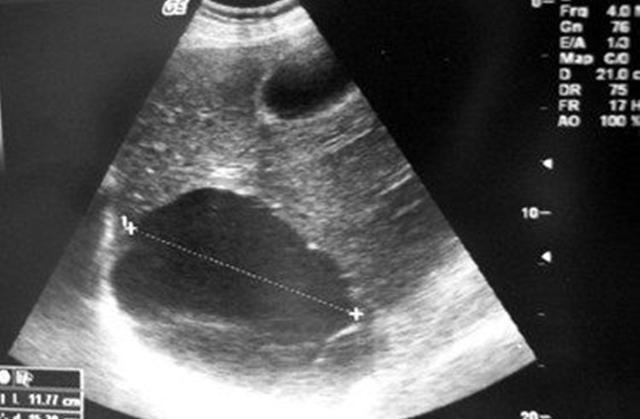 测一测你怀孕是怎么样的,怀孕如何测得准