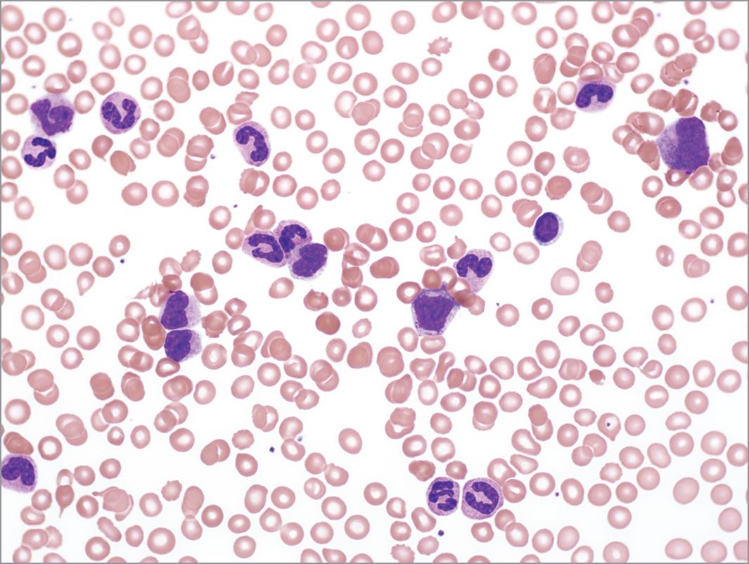 鱼病毒病解决方案,热带淡水鱼鱼病用药一览表