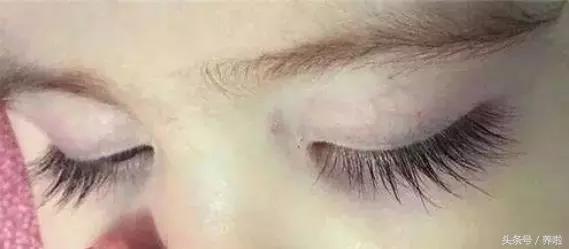 倒睫小宝宝,倒睫宝宝会怎么样