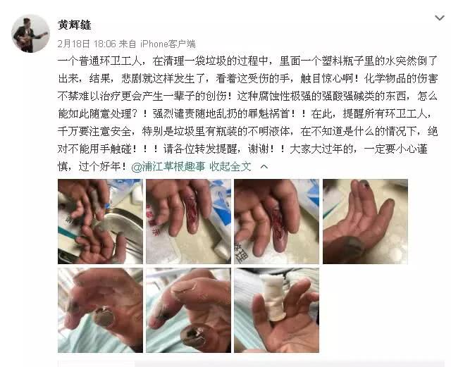 环卫工除夕夜捡垃圾被强酸腐蚀手指,网友:看着都疼的心里发毛