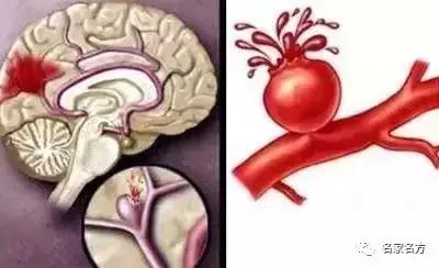 立春后男女保暖的部位,立春后冷40天