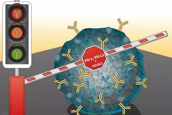 肺鳞癌最新治疗方法,肺鳞癌最新治疗方法一览表