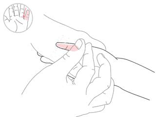 妈妈咳嗽怎么治疗,新妈妈应对宝宝咳嗽的小偏方