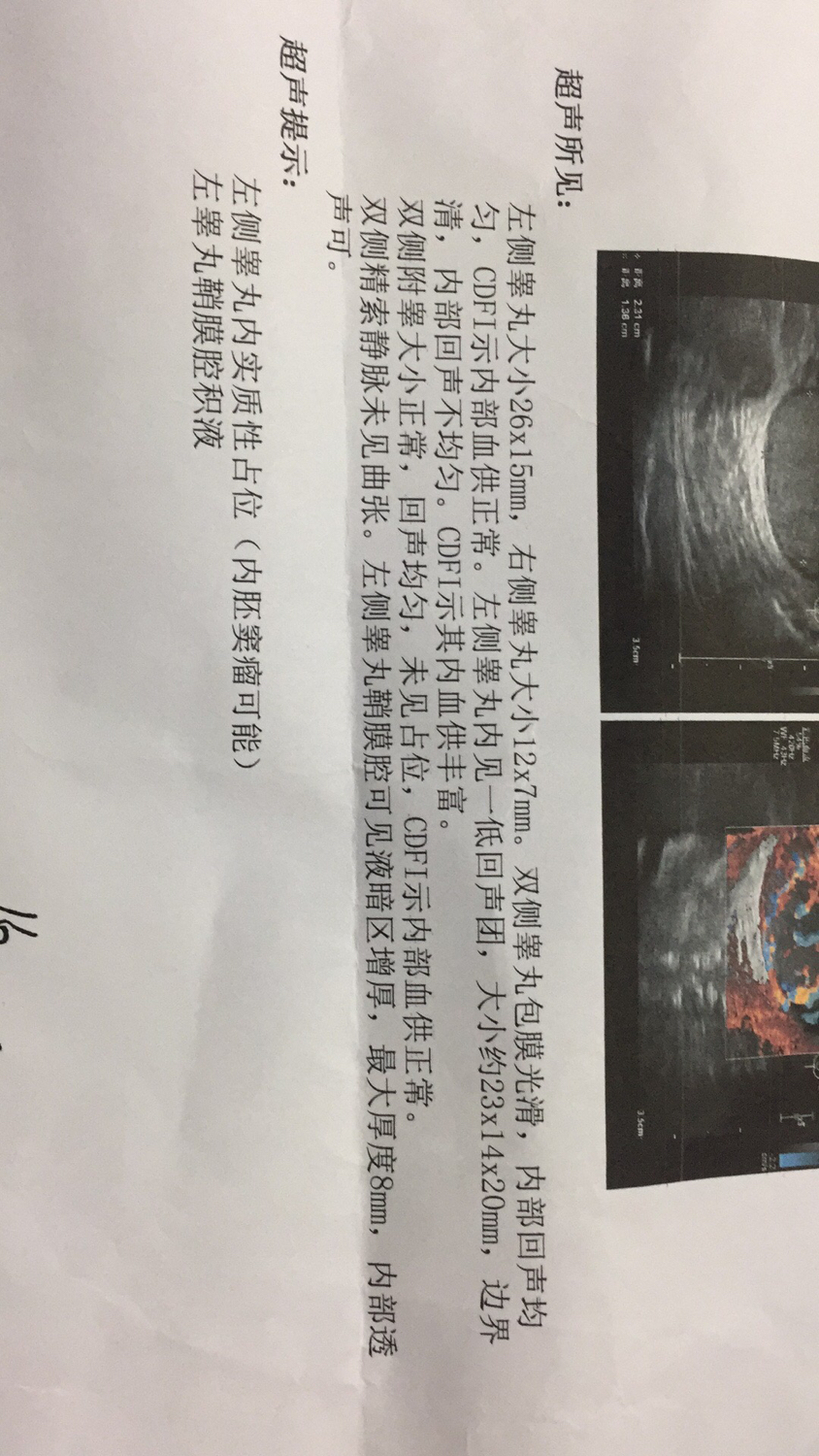 8个月宝宝内胚窦瘤严重吗,8个月孩子检查出基因突变