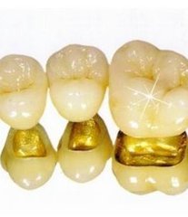 牙龈引起的口臭怎么解决,牙龈口臭牙根发黑