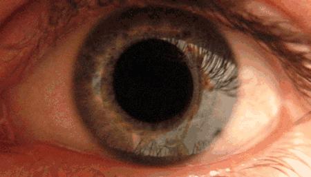 激光近视手术真的靠谱吗,激光近视手术靠谱吗