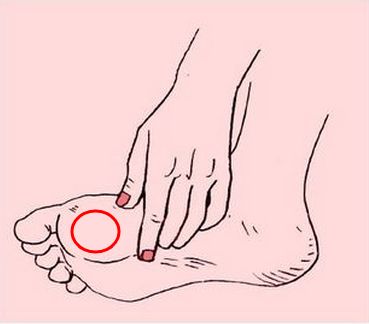 大拇指内侧打羽毛球磨出水泡,打羽毛球脚趾磨出水泡用什么药膏