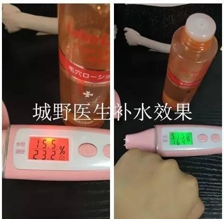 毛孔粗大的妹纸,毛孔大的妹子一定要看过来