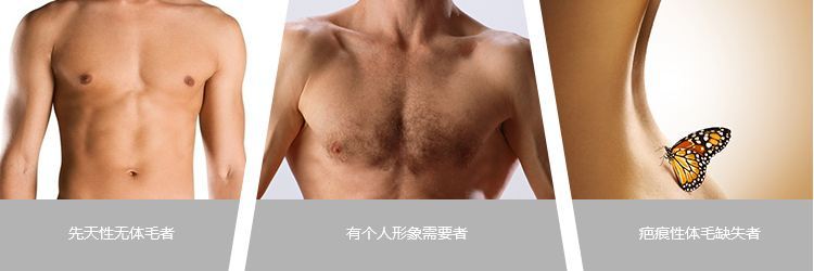 毛发种植有哪些风险,体毛种植后的效果