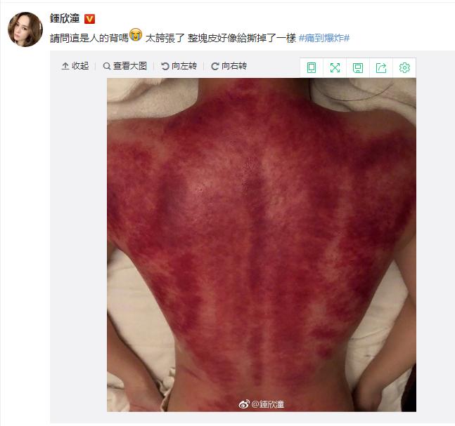 阿娇凌晨发裸背照，网友：我的内心毫无波动，甚至有点恶心