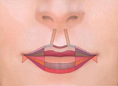 丰唇成香肠嘴视频,丰唇后像鸟嘴