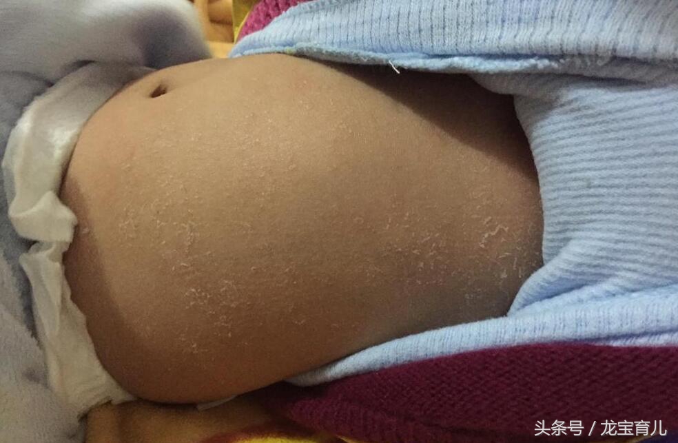 为什么宝宝出生后体重下降,为什么宝宝出生十天体重变轻了