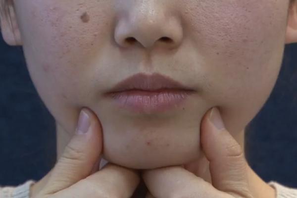 有双下巴怎么办才能瘦掉,有什么方法可以去除双下巴