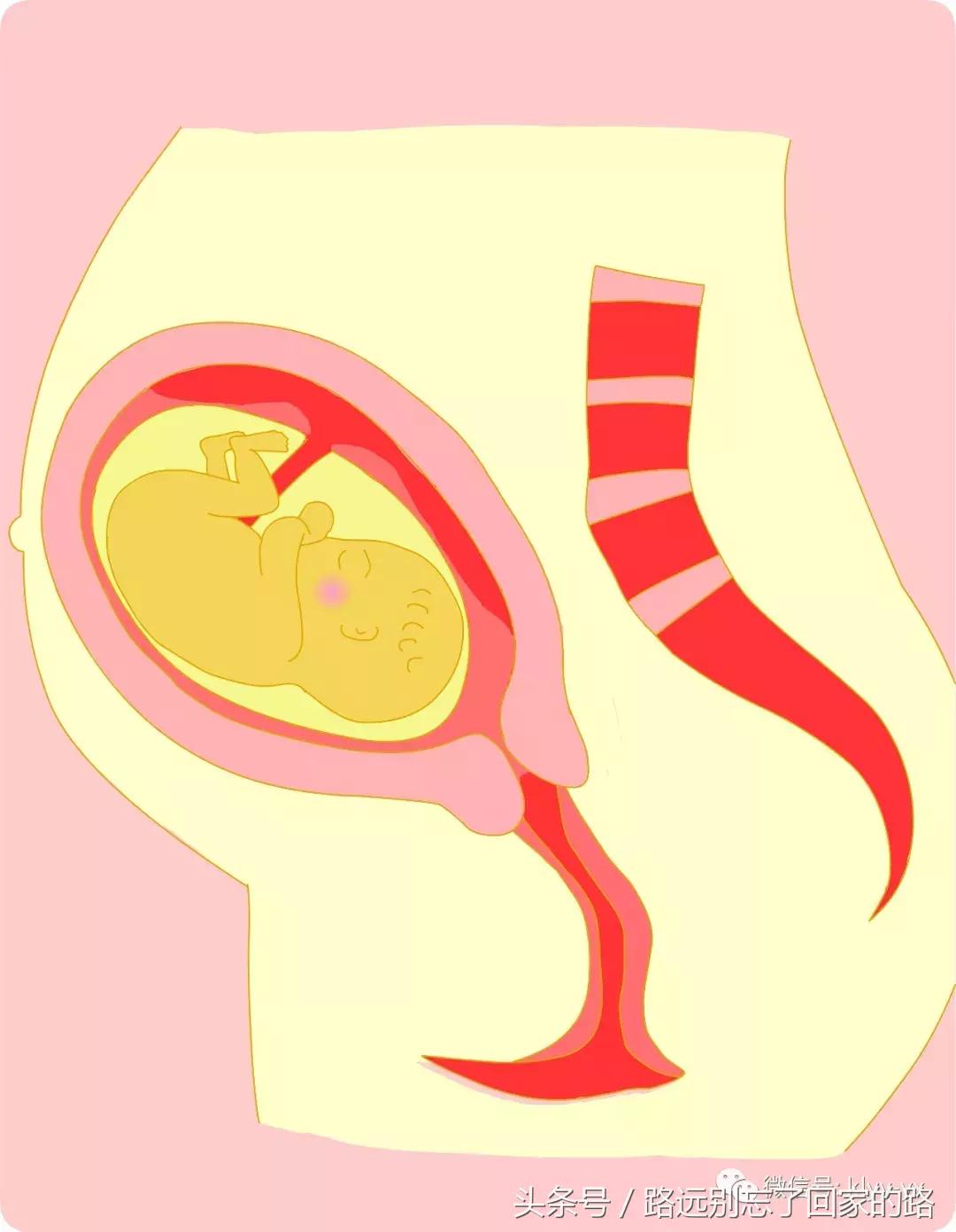 产科医生一般不会告诉你,这5种情况他们可能会考虑采取剖宫产!