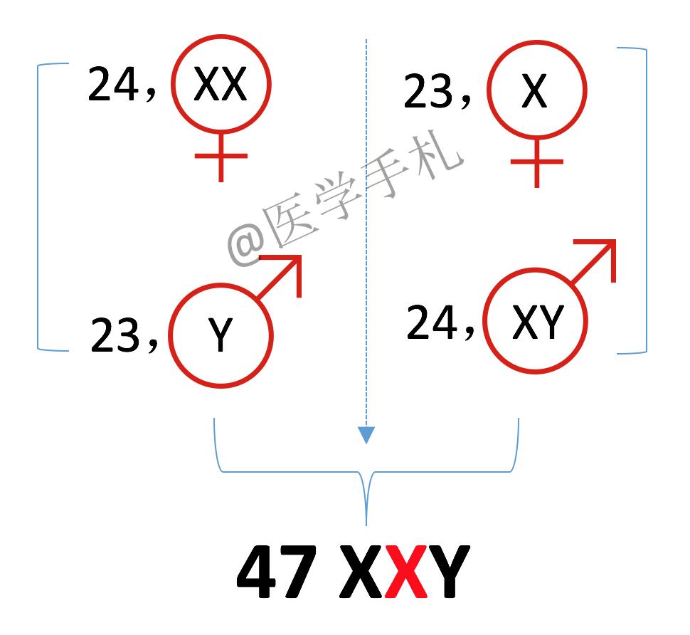 克氏综合征未来可以攻克吗,克氏综合征最新研究成果