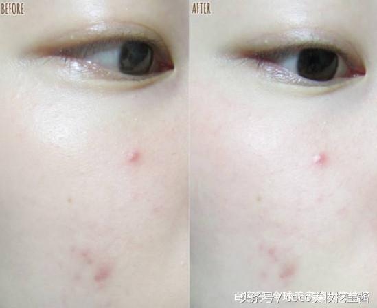 推荐一款清洁毛孔效果好的面膜,清洁皮肤提亮肤色哪款面膜好