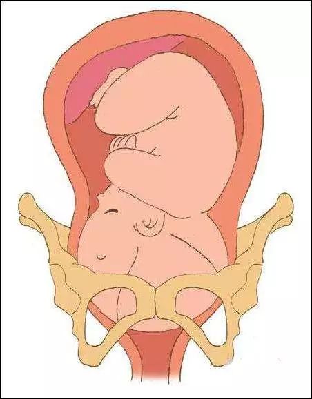 二胎可以治愈月子病吗,二胎治好月子病的例子