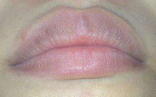 健康嘴唇颜色跟不正常区别,看看你的唇色是否健康