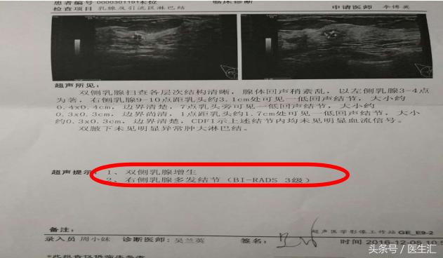 如何判定更年期综合征,更年期主要看哪个指标
