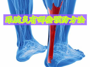 慢性跟腱炎怎么治疗最快最有效果,如何预防跟腱炎症