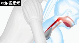 儿童呛到气管急救措施视频,儿童气管呛入异物怎么取出