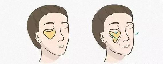 丰唇成香肠嘴视频,丰唇后像鸟嘴