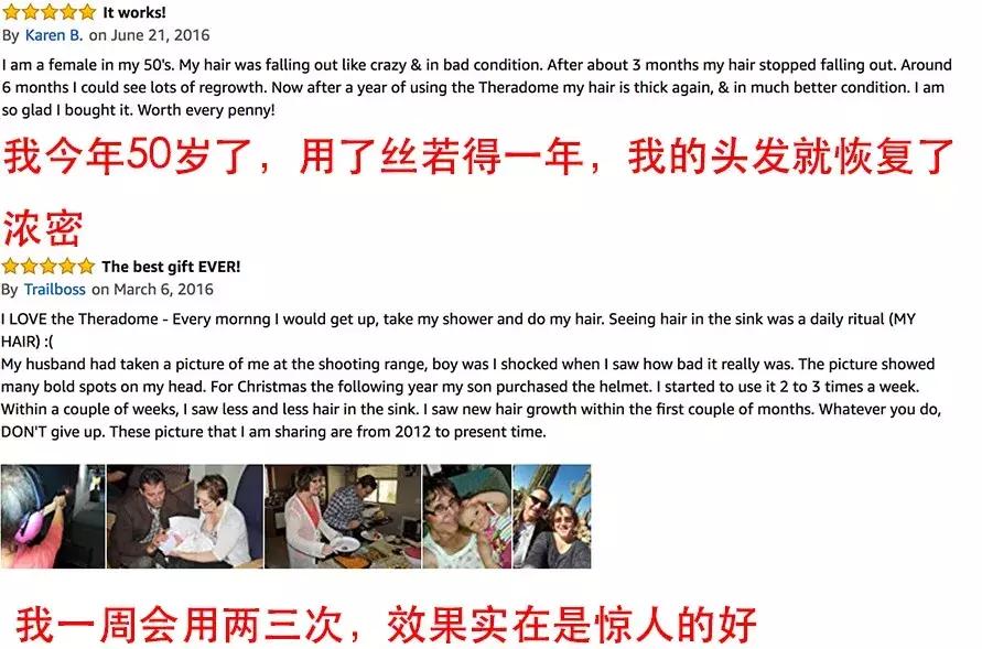 脂溢性脱发阶段,每个人都会有一段严重脱发期吗