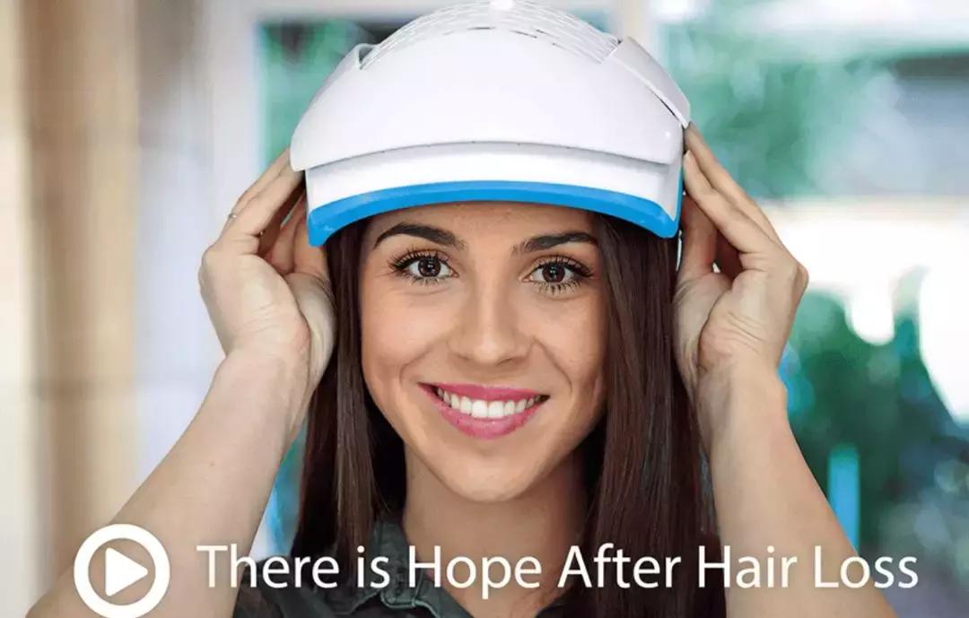 脂溢性脱发阶段,每个人都会有一段严重脱发期吗