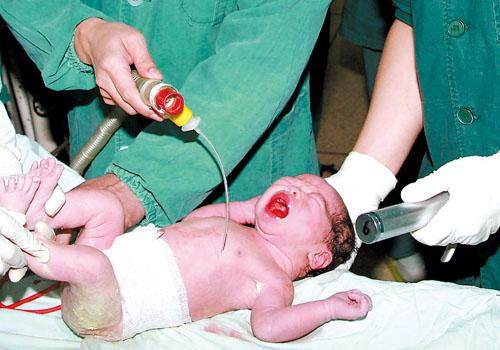 难产对产妇有什么影响,难产的孩子需要注意哪些问题