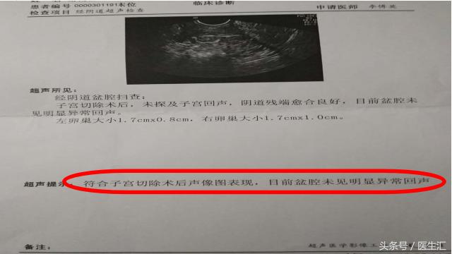 如何判定更年期综合征,更年期主要看哪个指标