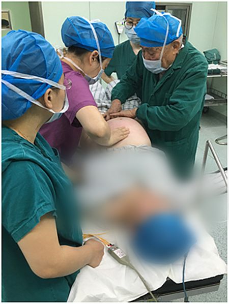 预产期要到了宝宝jio朝外?产科这套“乾坤大挪移”帮宝宝转身!